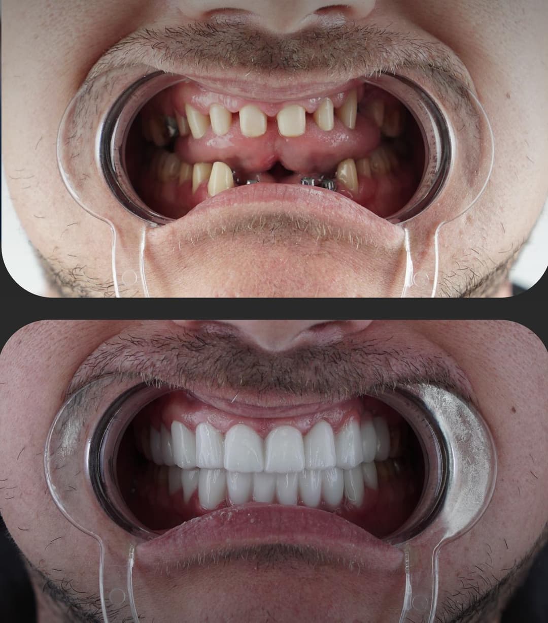 Before/After image 1