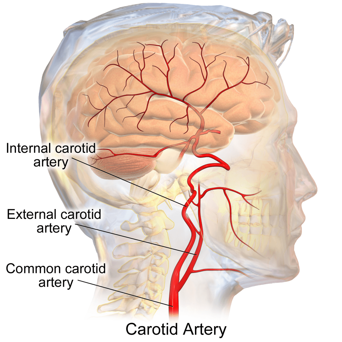 Carotid artery aneurysm medical condition