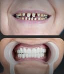 Özel Abat Medical Center - Before/After 3