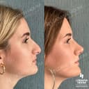 Lokman Hekim Health Group - Before/After 2