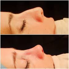 Before/After image 1