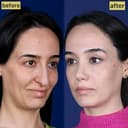 National Prime Hospital - Before/After 2