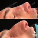 Lokman Hekim Health Group - Before/After 3