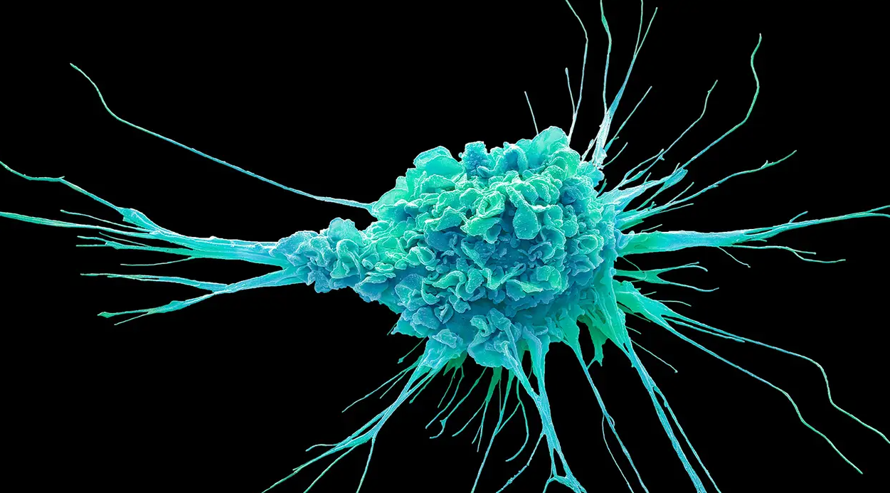 Dendritic Cell Therapy Abroad related image