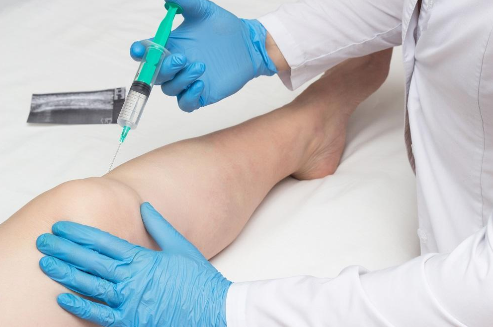 Stem Cell Treatment in Mexico: Costs and Best Clinics related image