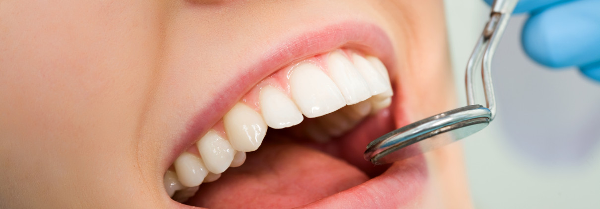 Full Mouth Dental Implants Turkey Package Deals related image