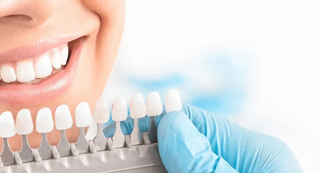 Full Mouth Dental Implants Turkey Package Deals related image