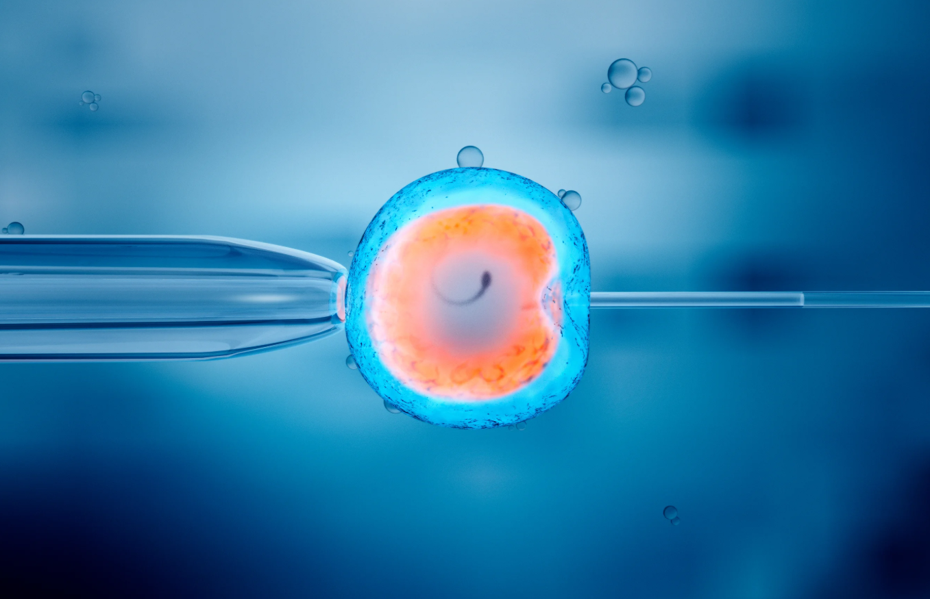 IVF in Mexico: Costs, Best Clinics & Medical Tourism related image