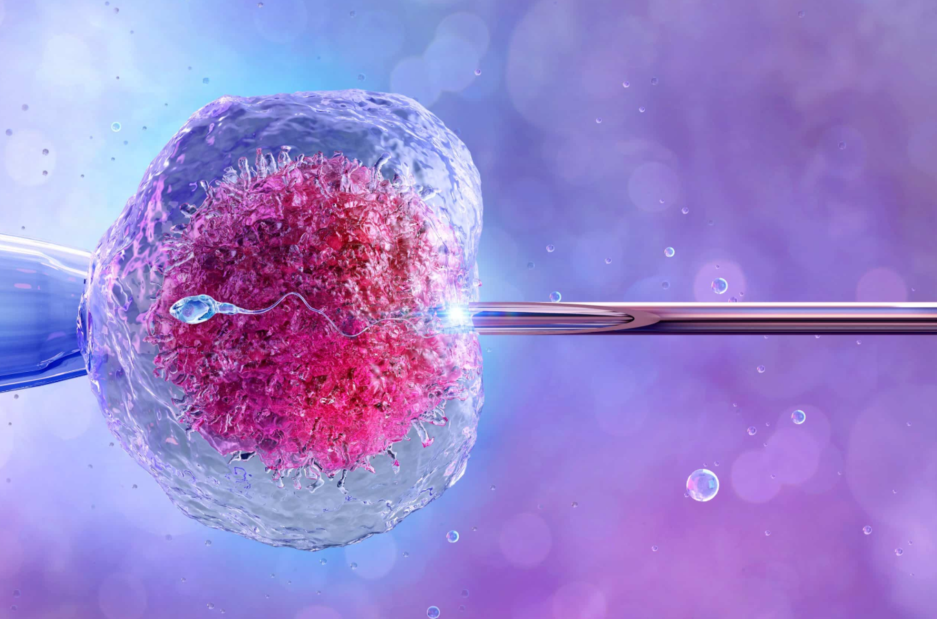 IVF in Mexico: Costs, Best Clinics & Medical Tourism related image