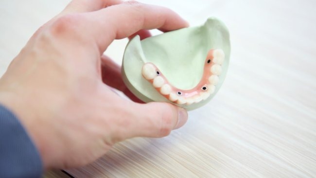 The Best and Cheapest Countries for All-on-6 Dental Implants related image
