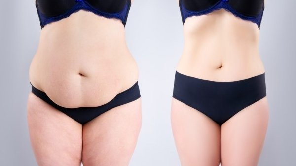 How Much Does Plastic Surgery Cost in Switzerland? related image