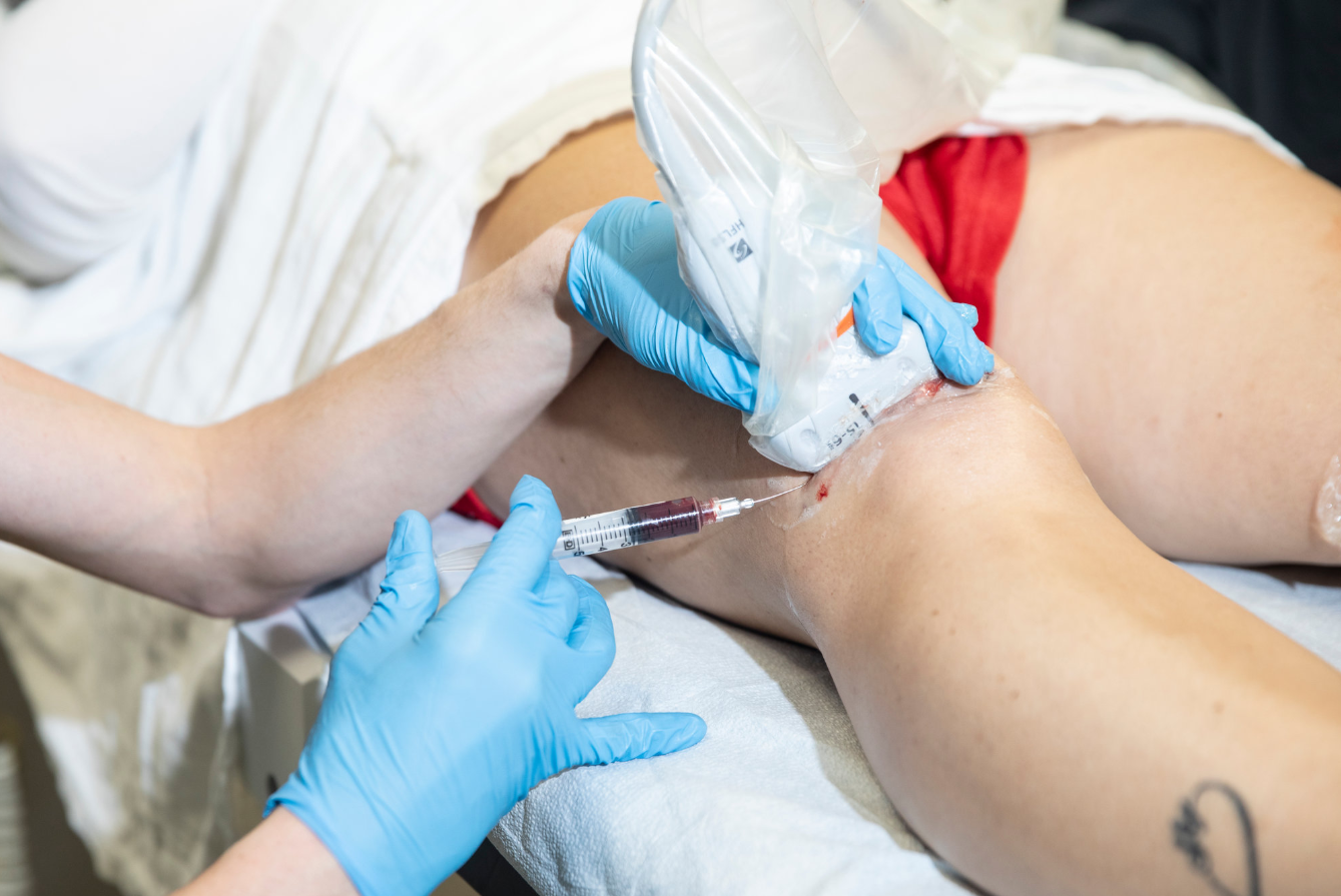 Stem Cell Treatment in Mexico: Costs and Best Clinics related image