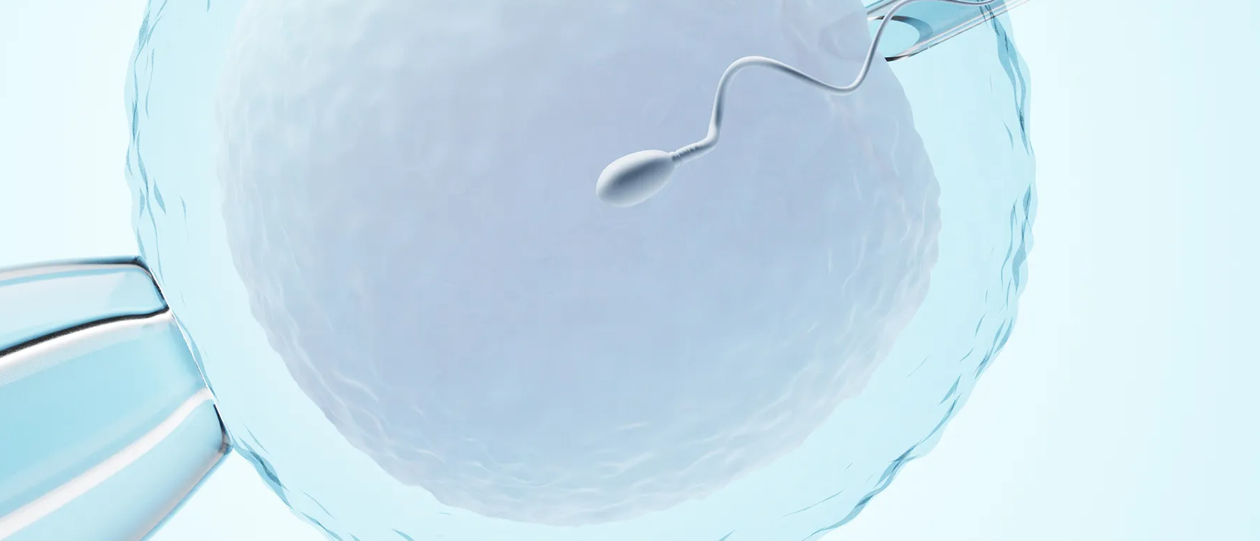 IVF in Mexico: Costs, Best Clinics & Medical Tourism related image