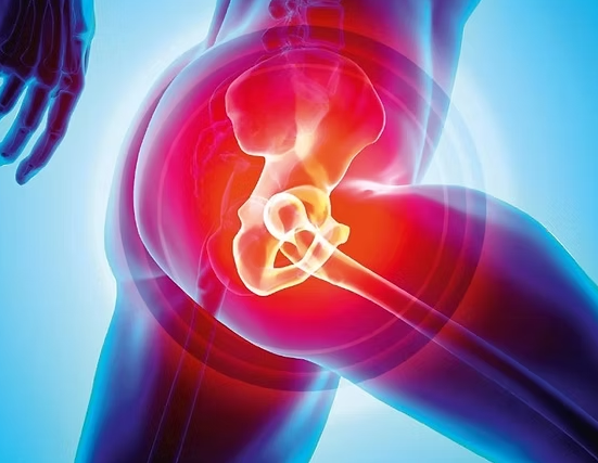 Hip Arthroscopy in Turkey related image