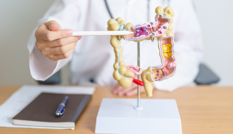 Colon Cancer Treatment in Turkey - Best Clinics & Doctors related image