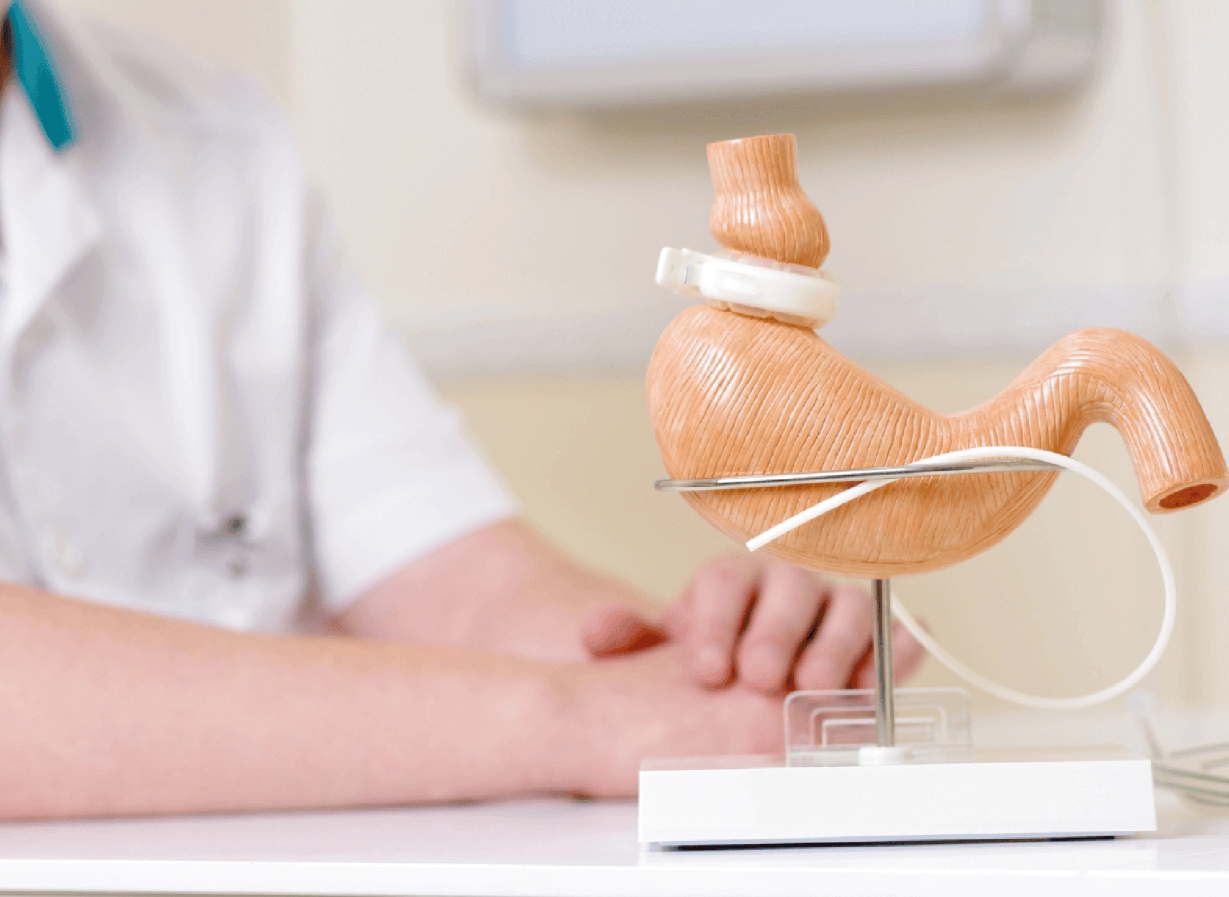 Revision Bariatric Surgery Turkey | 2026 Costs & Clinics related image