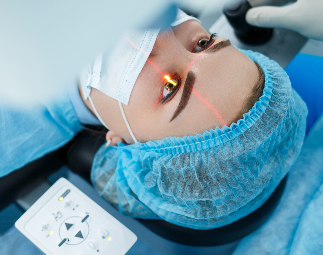 Cataract Surgery Cost in Turkey: Quality and Affordable Eye Care related image