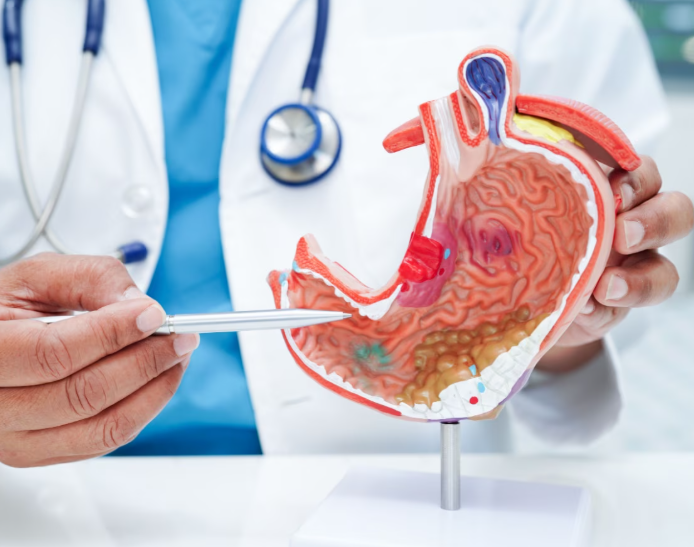 Stomach Cancer Treatment in Turkey related image