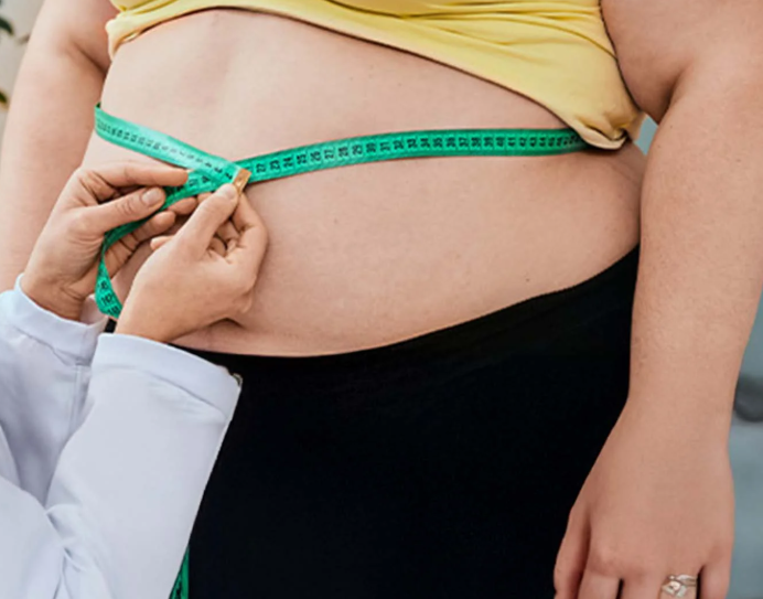 Gastric Band Turkey - Affordable Gastric Band Packages from 4000€ related image