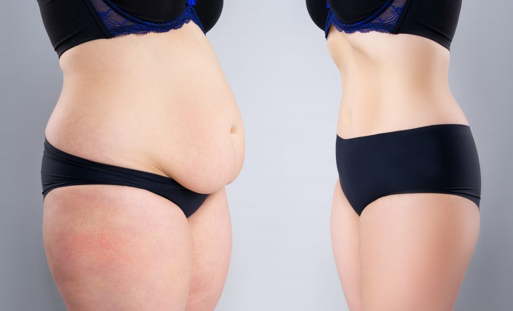 Cosmetic Surgery in Turkey related image