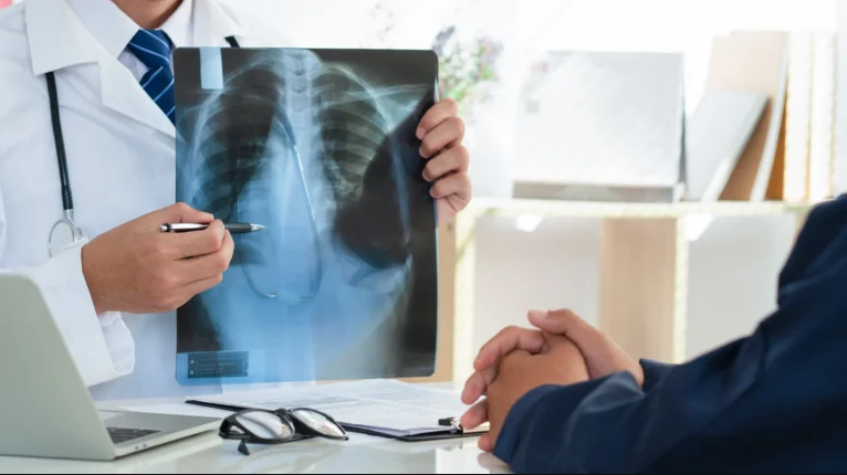Cancer Treatment in Turkey related image