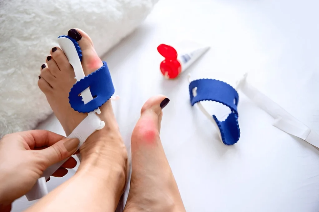 Bunion & Hallux Valgus Surgery in Turkey related image
