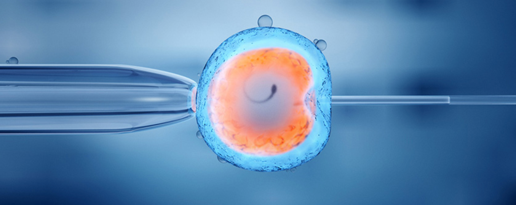Affordable IVF  in Turkey: 2026 Costs & High-Success Results related image