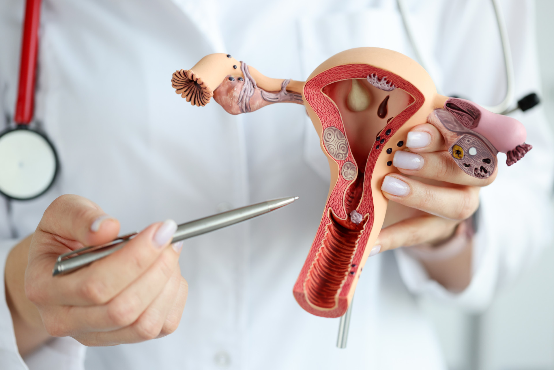 Endometriosis Treatment in Turkey related image