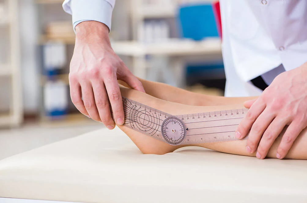 Limb Lengthening Surgery in Turkey: 2026 Costs and Best Clinics related image
