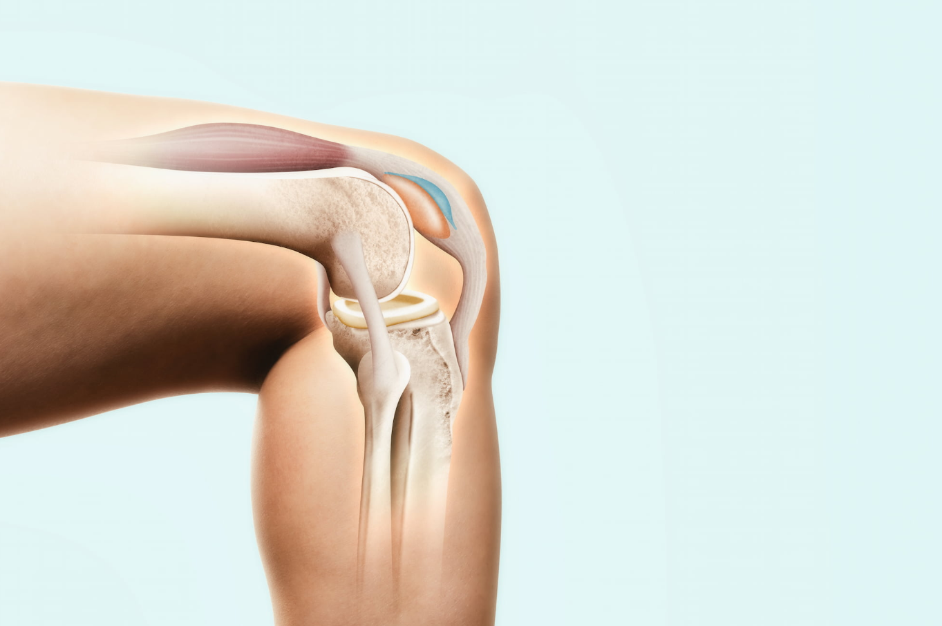 Arthroscopic Knee Surgery in Turkey - Costs and Best Clinics related image