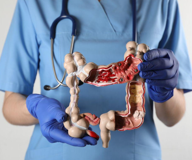 Colon Cancer Treatment in Turkey - Best Clinics & Doctors related image