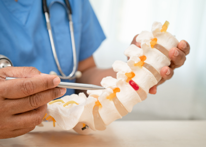 Spinal Fusion Surgery in Switzerland related image