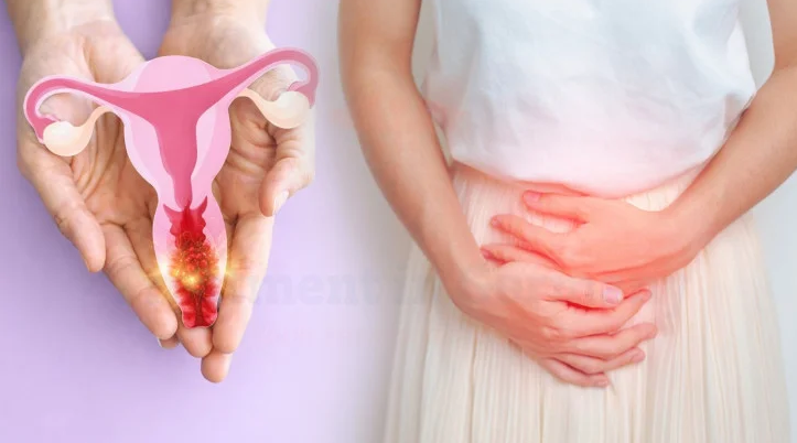 Cervical Cancer Treatment in Turkey related image