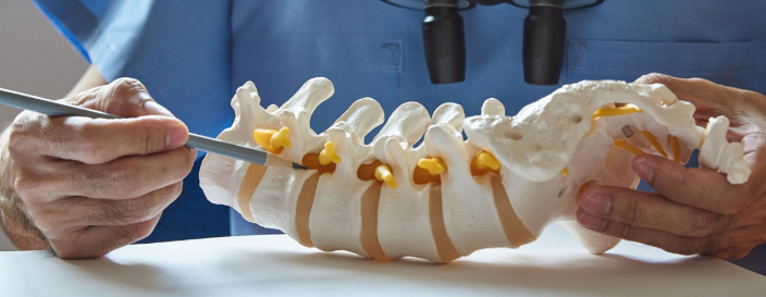 Spine Surgery in Turkey related image