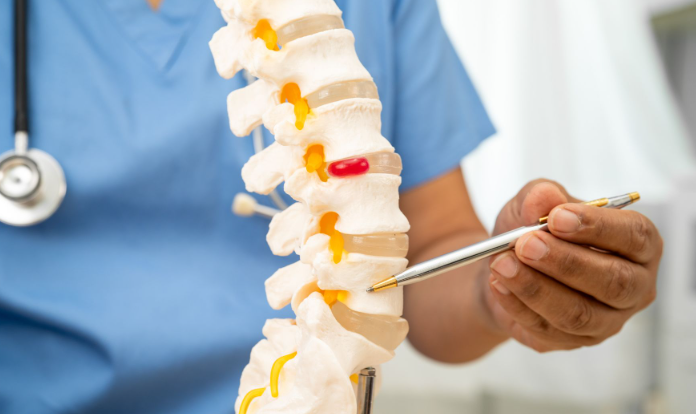 Best and Cheapest Countries for Spine Surgery Abroad related image