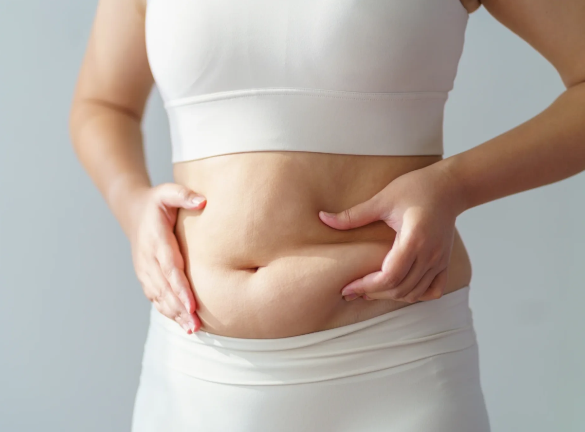 Tummy Tuck Surgery in Tijuana, Mexico related image
