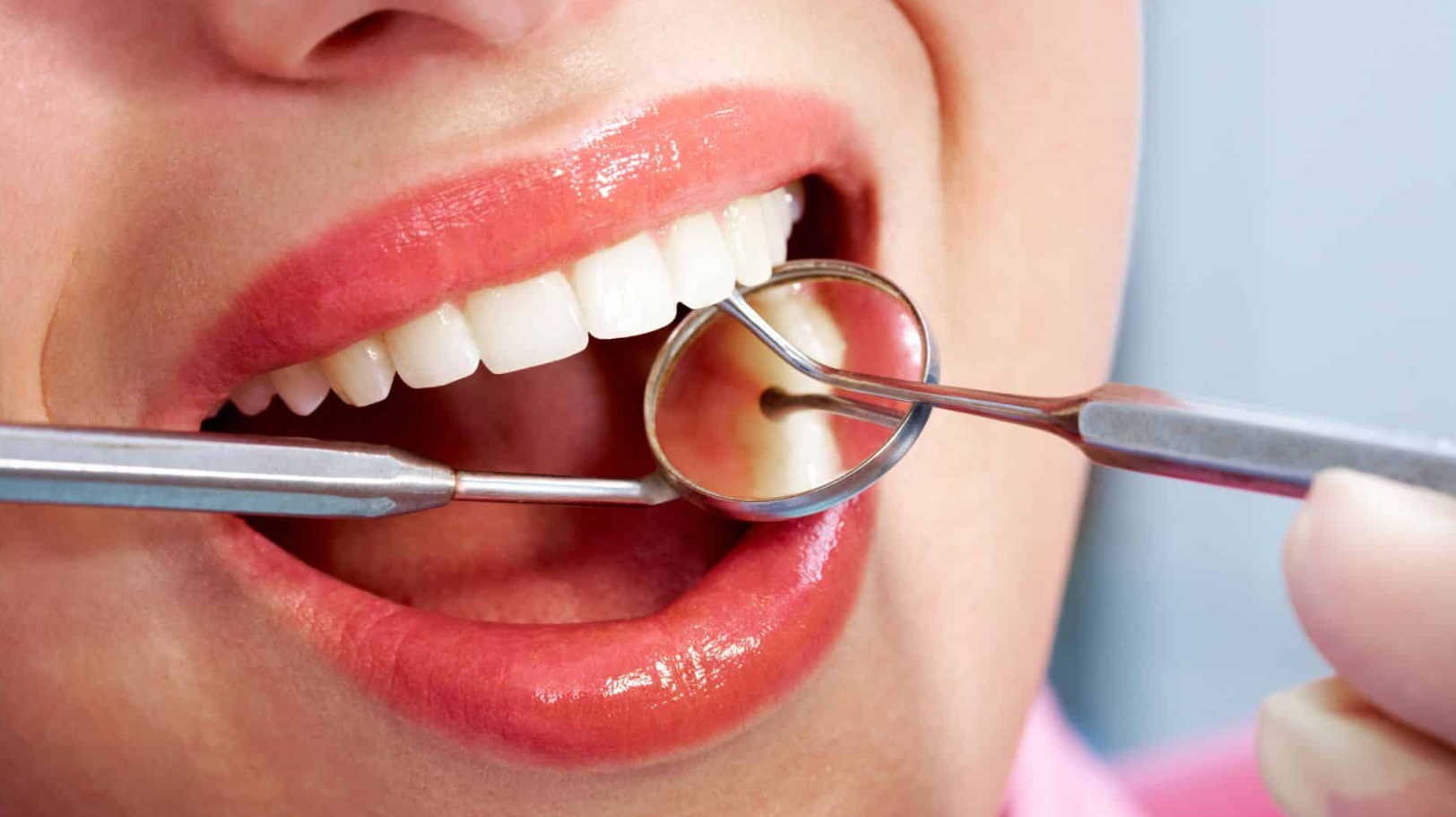 Dental Treatment in Turkey related image