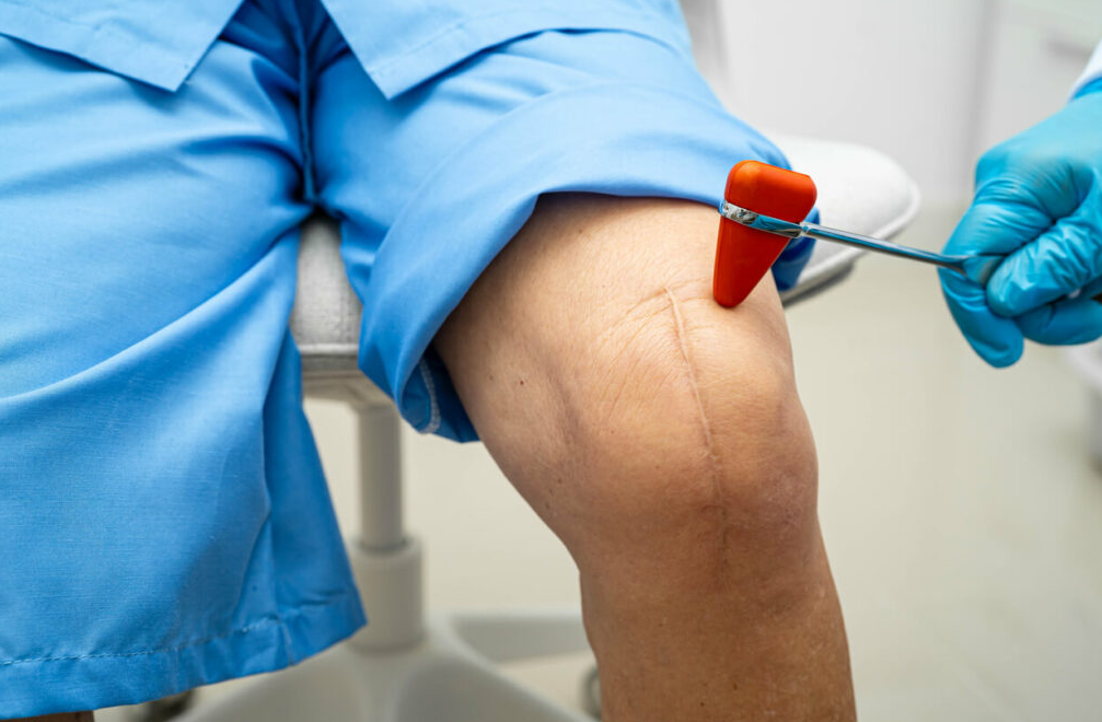Arthroscopic Knee Surgery in Turkey - Costs and Best Clinics related image