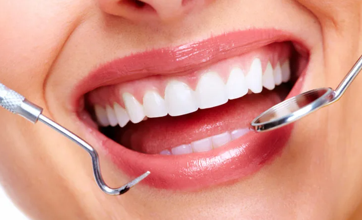 Dental Treatment in Turkey related image