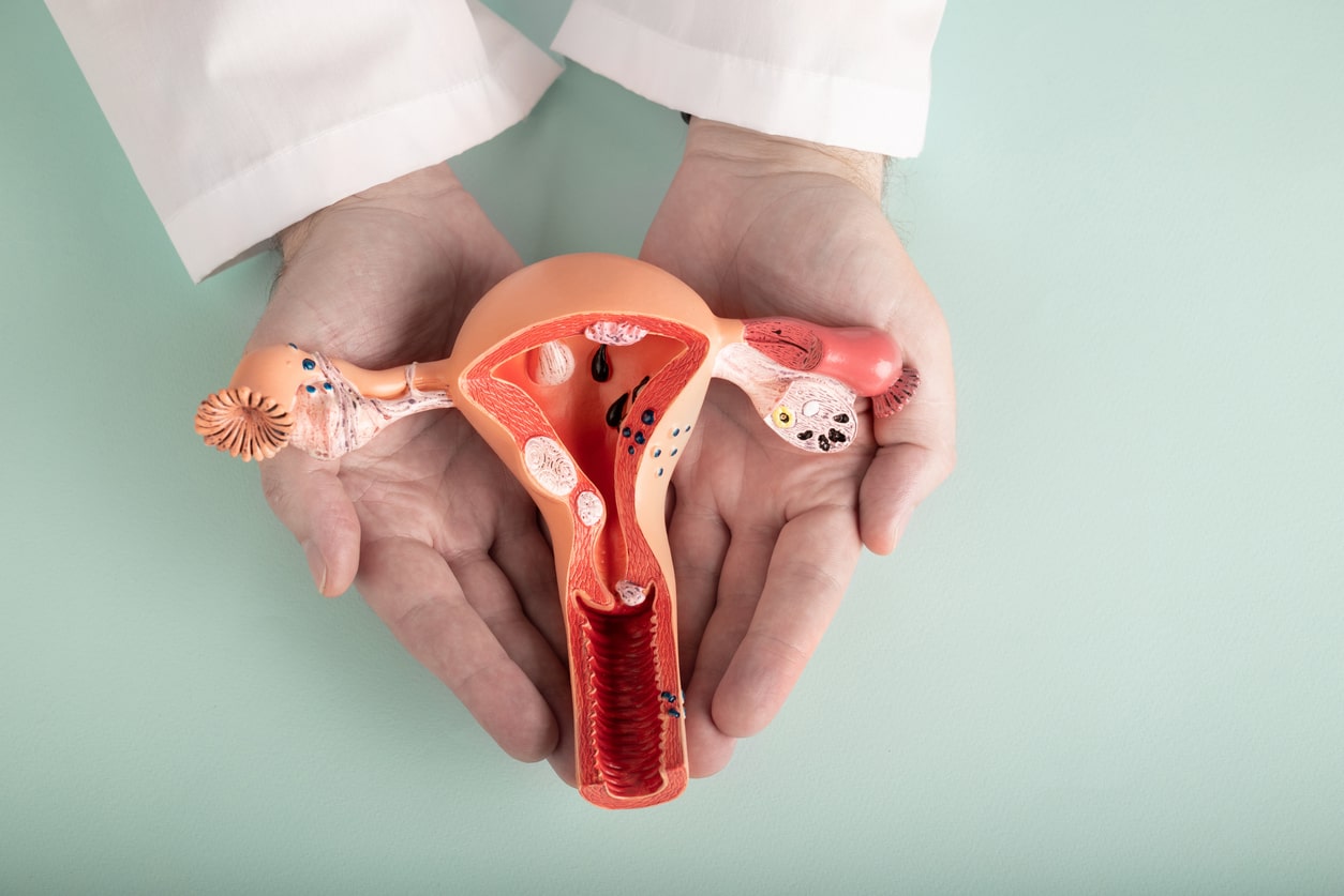 Endometriosis Treatment in Turkey related image
