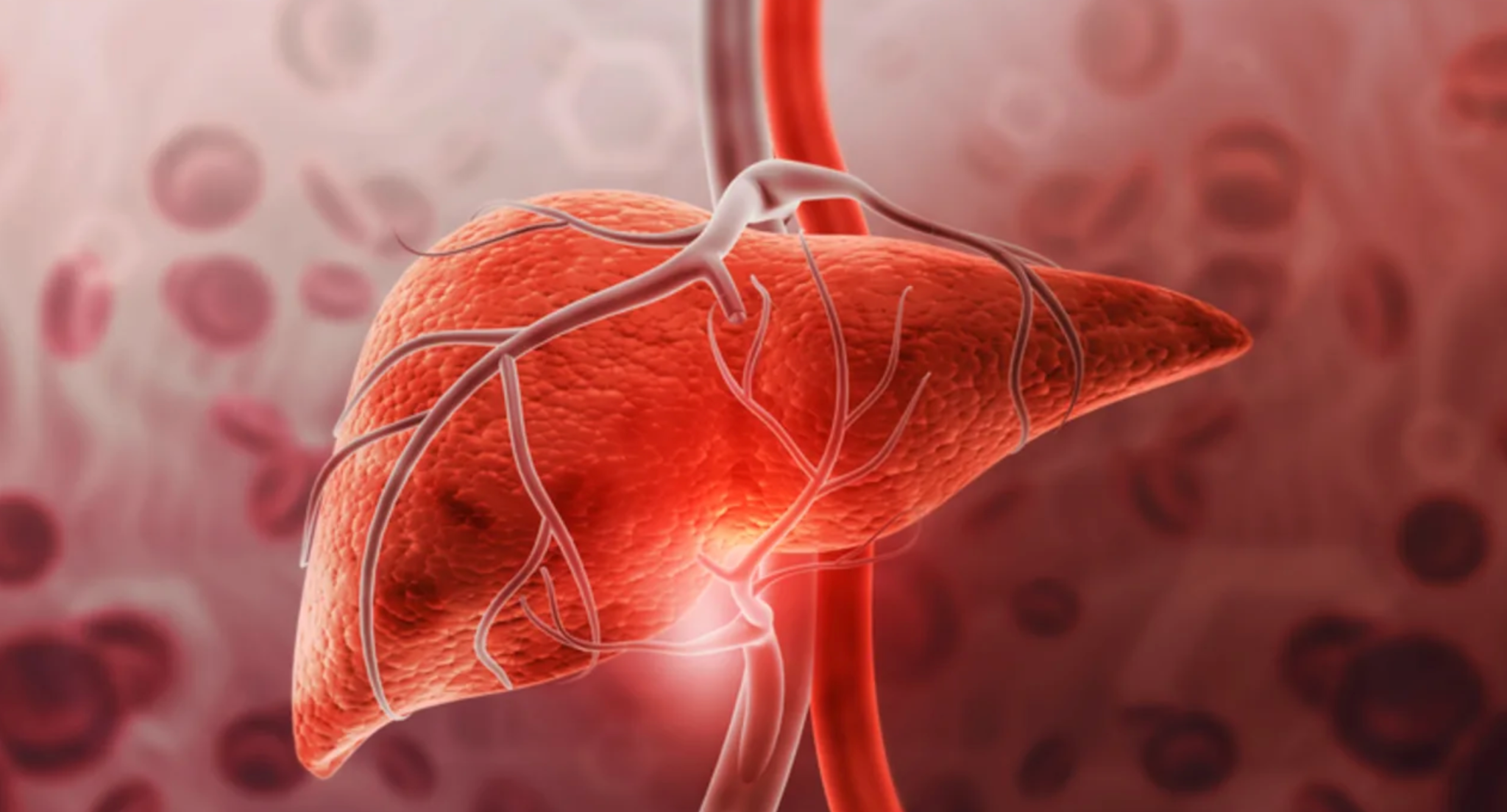 The Ultimate Guide to Liver Transplant Cost in Turkey related image