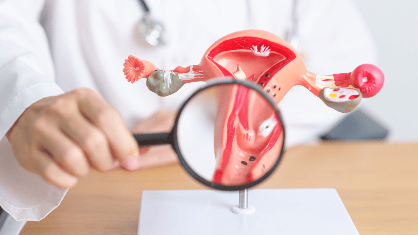 Cervical Cancer Treatment in Turkey related image
