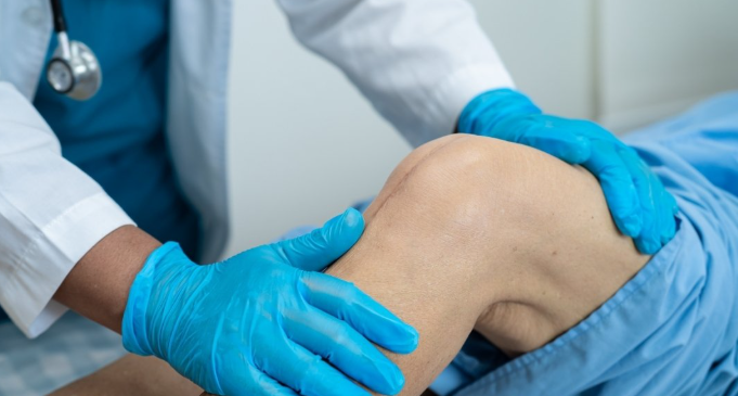 Knee Replacement in Mexico - 80% Cost Savings, No Waiting Lists related image