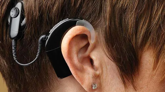 Best and Cheapest Countries for Cochlear Implant Abroad related image
