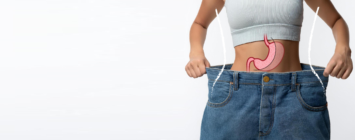 Gastric Sleeve in Turkey | 2026 Prices, & Top Hospitals related image