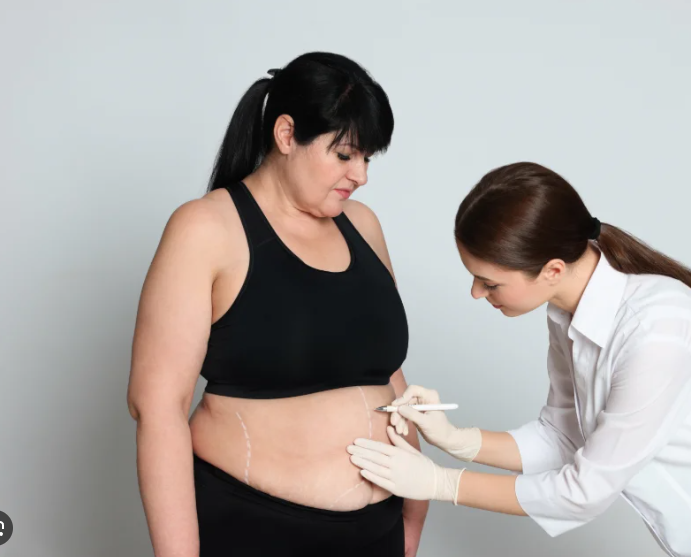 Gastric Band Turkey - Affordable Gastric Band Packages from 4000€ related image
