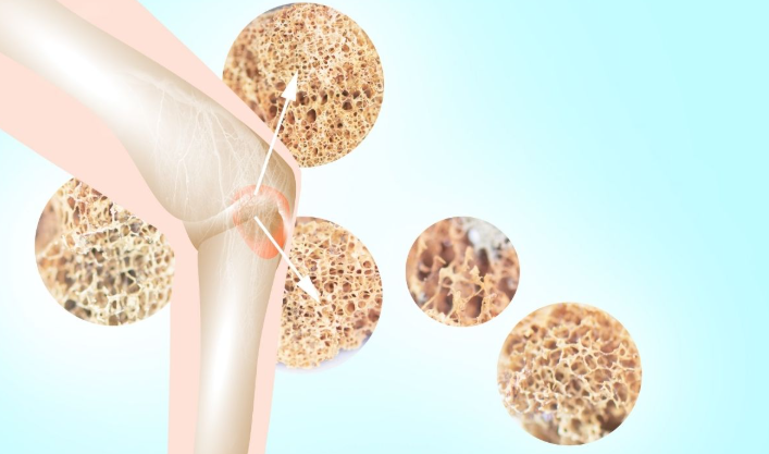 Bone Cancer Treatment in Turkey related image