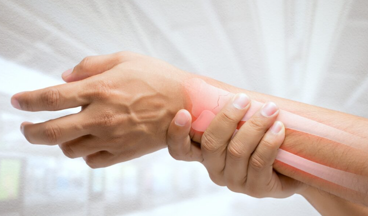 Wrist Replacement Surgery in Turkey related image