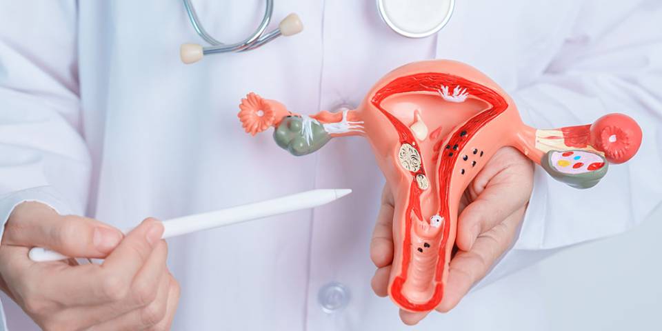 Endometriosis Treatment in Turkey related image