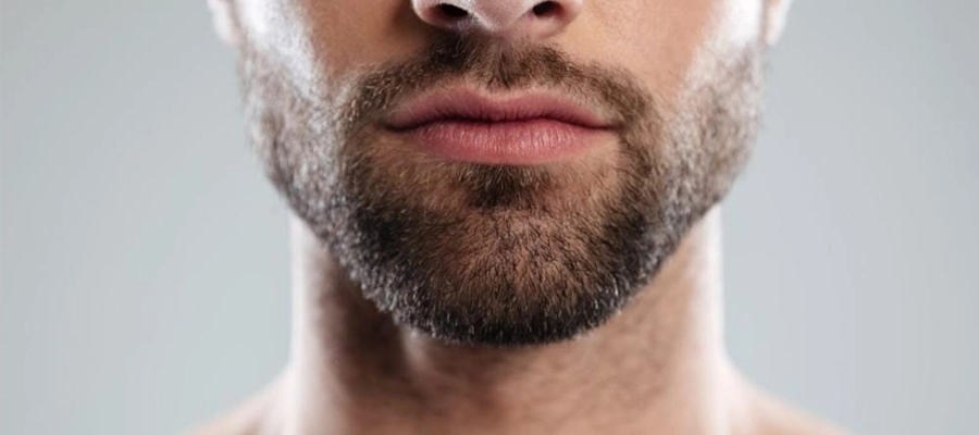 Beard Transplant in Turkey related image